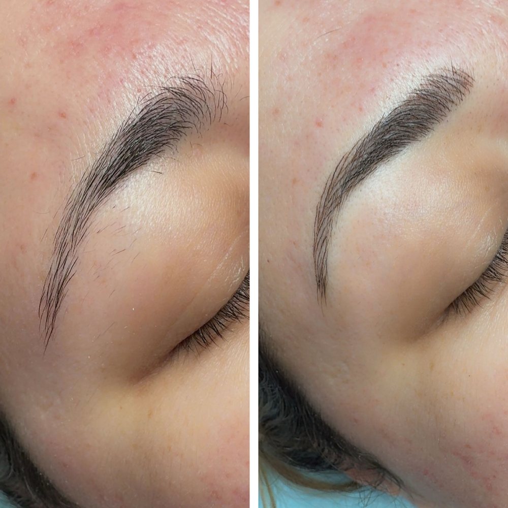 Brow before, left, and after, right