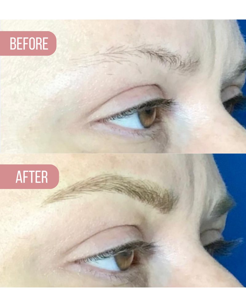 Brow before, above, and after, below