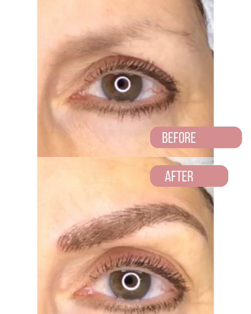 Brow before, above, and after, below