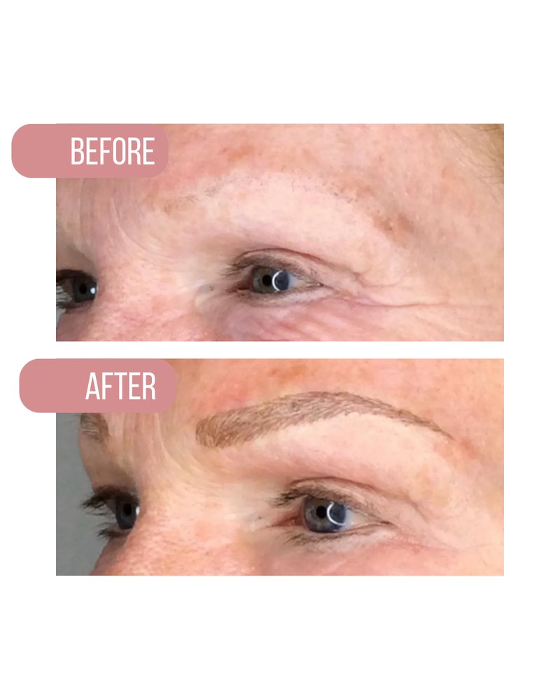 Brow before, above, and after, below
