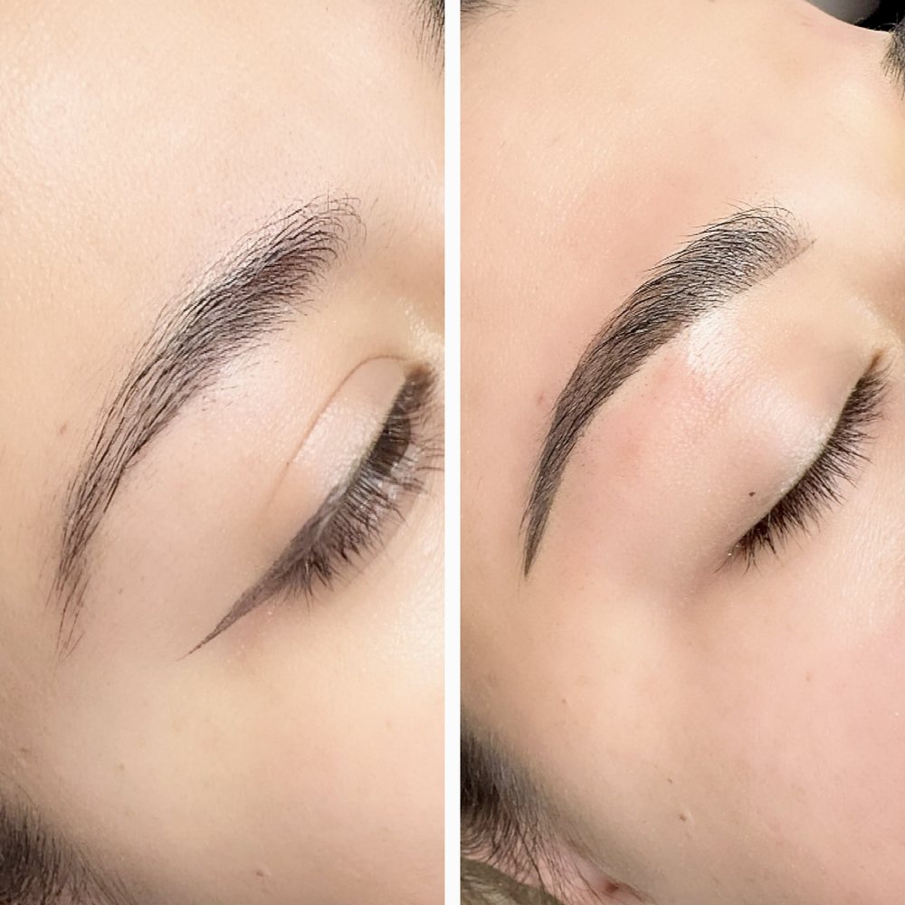 Brow before, left, and after, right