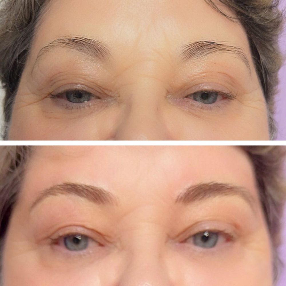 Brows before, above, and after, below