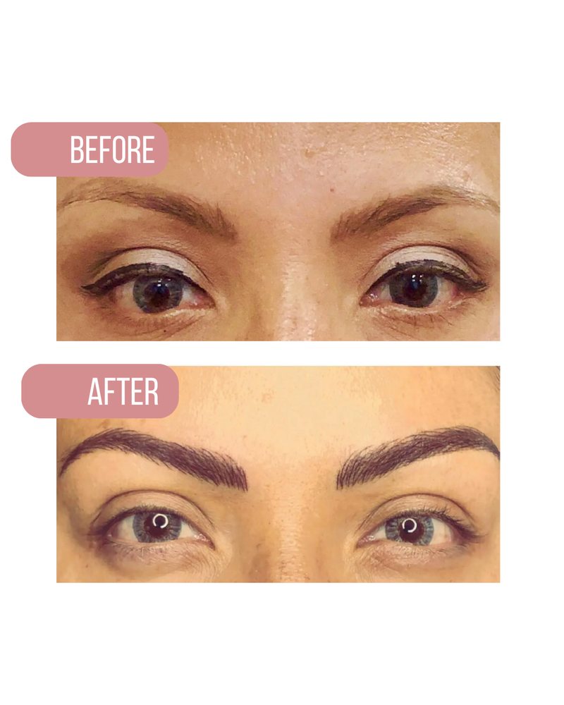 Brows before, above, and after, below