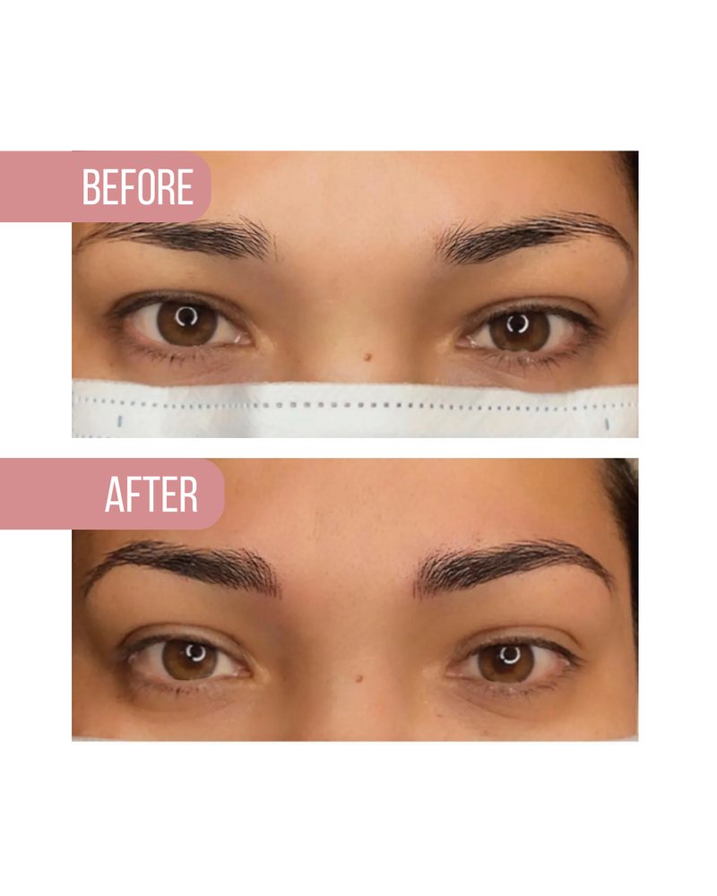 Brows before, above, and after, below