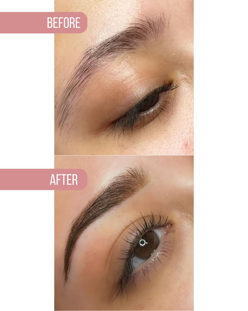 Brow before, above, and after, below
