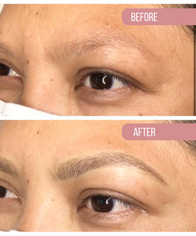 Brow before, above, and after, below