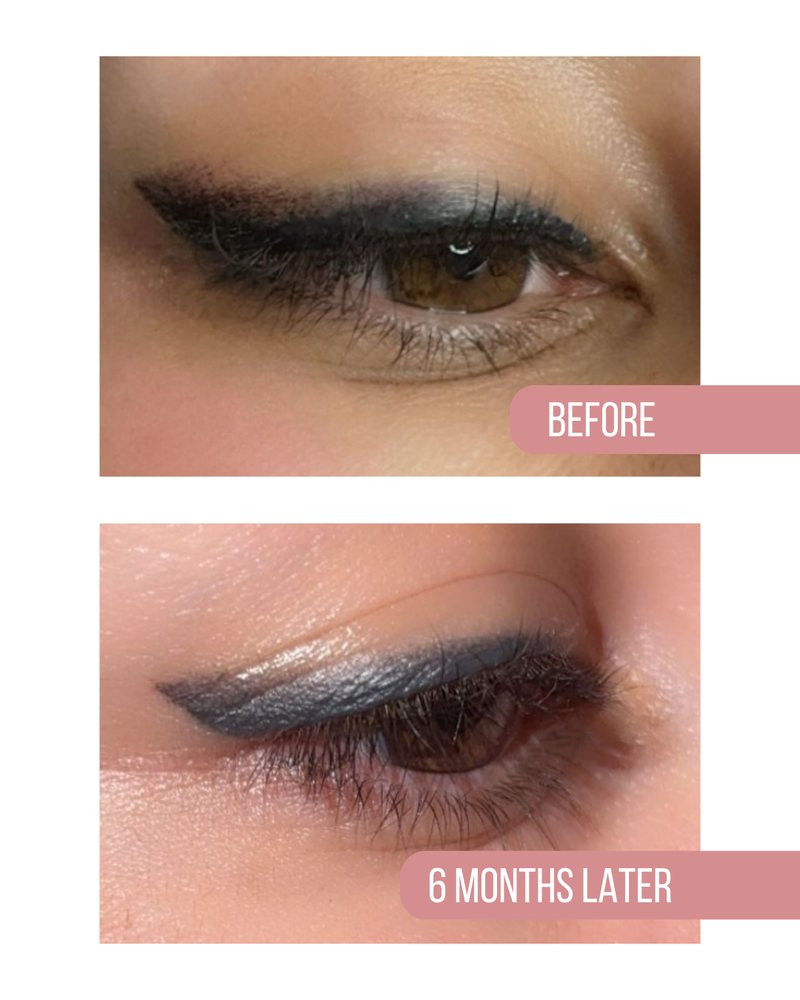 Eyeliner before, above, and six months later, below