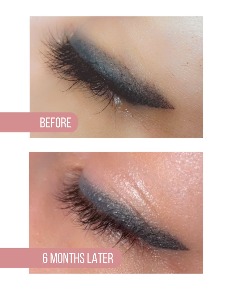 Eyeliner before, above, and six months later, below