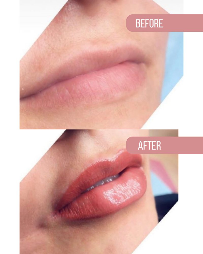 Lips before, above, and after, below