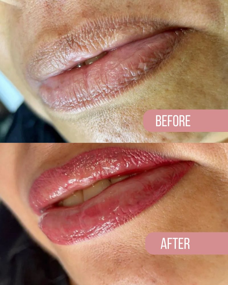 Lips before, above, and after, below